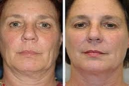 Anti Aging Clinic in Islamabad