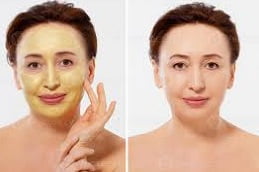 Anti Aging Treatment in Islamabad, Pakistan