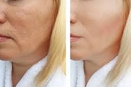 Best Anti Aging Clinic in Islamabad, Pakistan