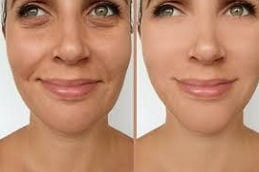 Best Anti Aging Clinic in Islamabad