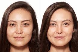 Best Skin Whitening Clinic in Islamabad