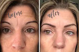 Microblading Clinic in Islamabad, Pakistan