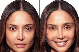 Permanent Skin Whitening Treatment in Islamabad