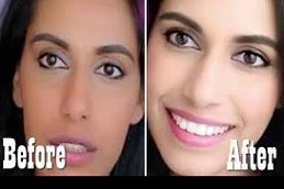 Skin Whitening Treatment Clinic in Islamabad