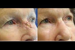 Best facial-scar-revision Clinic in Islamabad