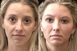 Best fat-transfer-treatment Clinic in Islamabad 