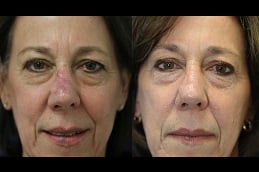 facial-scar-revision Clinic in Islamabad