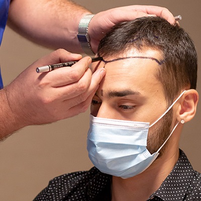 Cheap and Best Hair Transplant in Islamabad