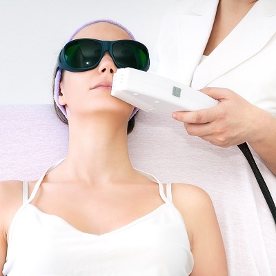 Permanent Facial Hair Removal for Women