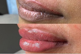 Permanent Lip Color Treatment Price in Pakistan