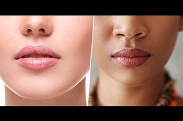 dark lips treatment cost in ISLAMABAD
