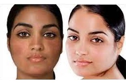 dos and donts when taking glutathione injections in islamabad
