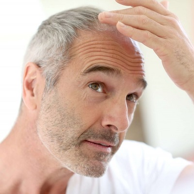 How Long Does Hair Restoration Recovery?