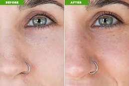 best deep cleansing facial cost in islamabad
