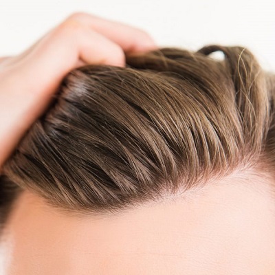 Frequently Asked Questions About Hair Transplant Surgery