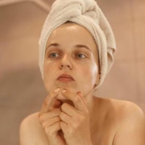 Say Goodbye to Acne: Effective Treatment Options