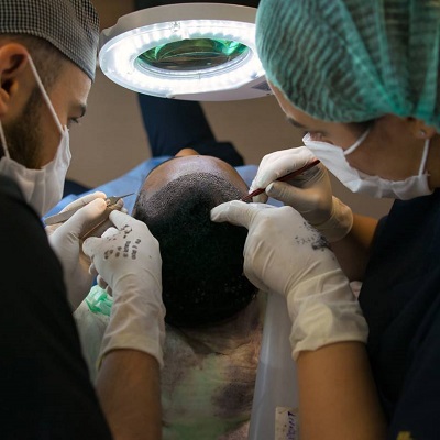 Best Doctors for FUE Hair Transplant Islamabad & Pakistan Cost