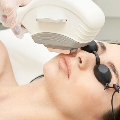 Face Laser Hair Removal Islamabad & Pakistan
