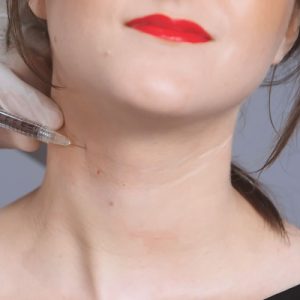 Botox For Neck Wrinkles: Is It Right For You?