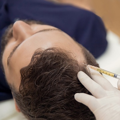 PRP: Natural Approach to Hair Regrowth and Rejuvenation