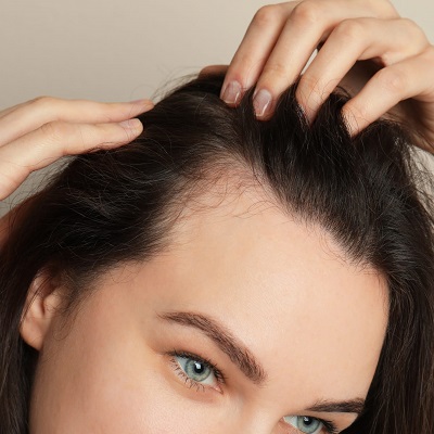 Exosomes for Hair Loss Price in Pakistan