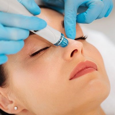 Why Does My Face Look Worse after a Hydrafacial Treatment?