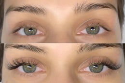 Best Clinic of Eyelash Extensions Treatment Islamabad
