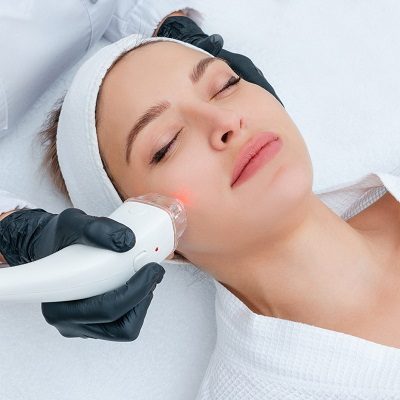 Best Laser Treatments in Islamabad Pakistan Skin Care Clinic