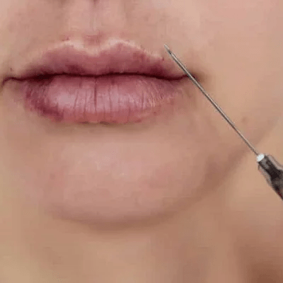 Revolax Filler Price in Pakistan Islamabad