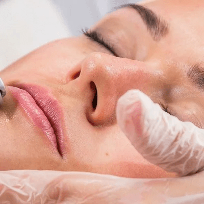 Derma Rollers Treatment in Islamabad, Rawalpindi & Pakistan Cost