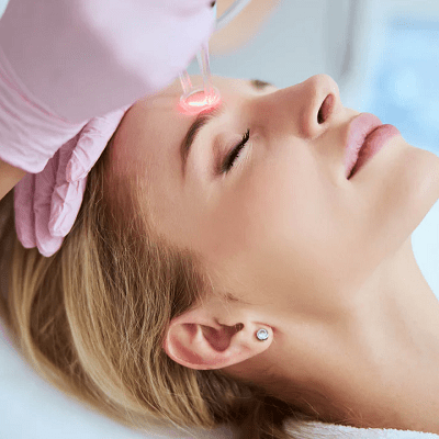 Fractional Co2 Laser Treatment in Islamabad, Rawalpindi Pakistan Cost