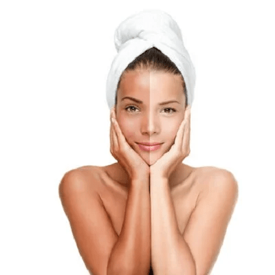 Glutathione Skin Whitening Injections for Women's in Islamabad Cost