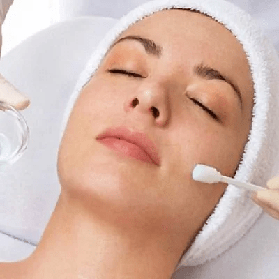 Glycolic Peel Treatment in Islamabad, Rawalpindi & Pakistan Cost