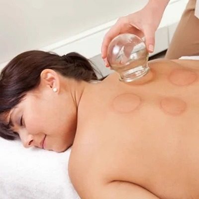 Hijama Cupping Therapy in Islamabad & Pakistan Best Hijama Cost