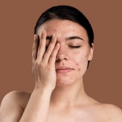 Common Skin Conditions and How to Treat Them