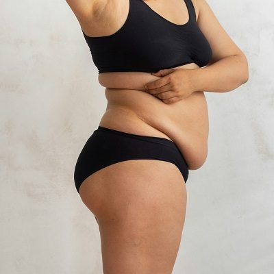 Post Weight Loss in Islamabad Pakistan - Glamorous Cost & Results
