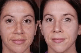 Best Melsama Clinic in Islamabad