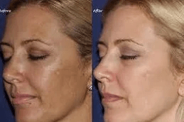 Melsama Clinic in Islamabad