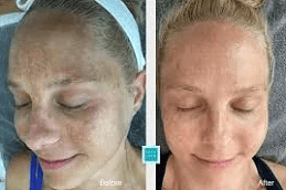 Melsama Treatment Clinic in Islamabad