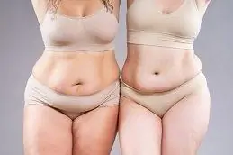Results OF Best Tummy Tuck Surgeon clinic Islamabad