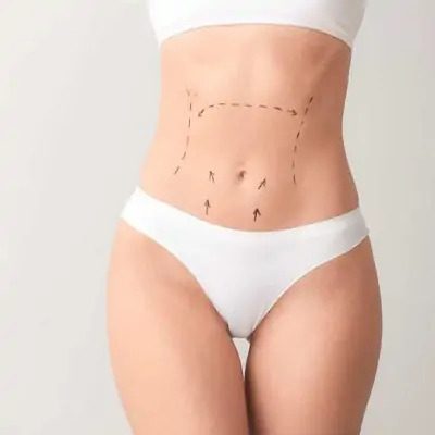 How painful is tummy tuck recovery?