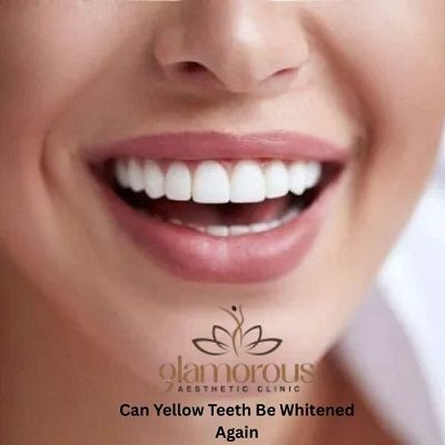 Can Yellow Teeth Be Whitened Again?
