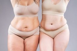 Tummy Tuck before & After Islamabad