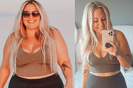 mounjaro before & After islamabad