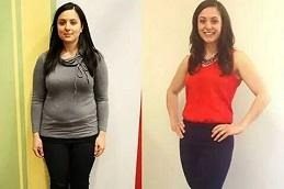 mounjaro injection before & After clinic islamabad