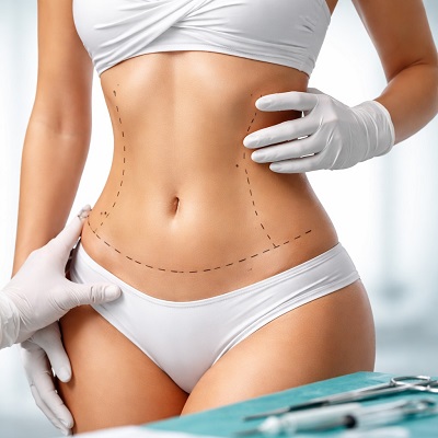 What Exercises Are Safe After a Tummy Tuck Surgery?