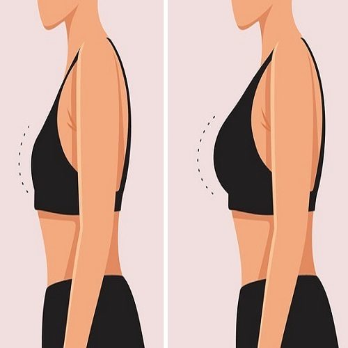 Breast Implants in Before & After clinic Islamabad Pakistan