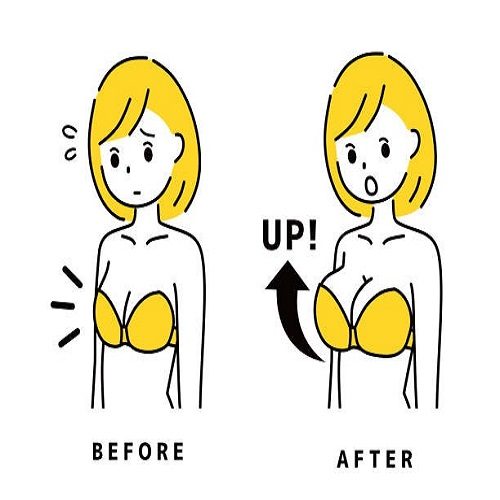 Breast Implants in Before & After clinic Islamabad