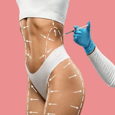 Cost of Body Fillers in Islamabad Pakistan