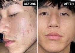 Hyaluronicacid in Islamabad result